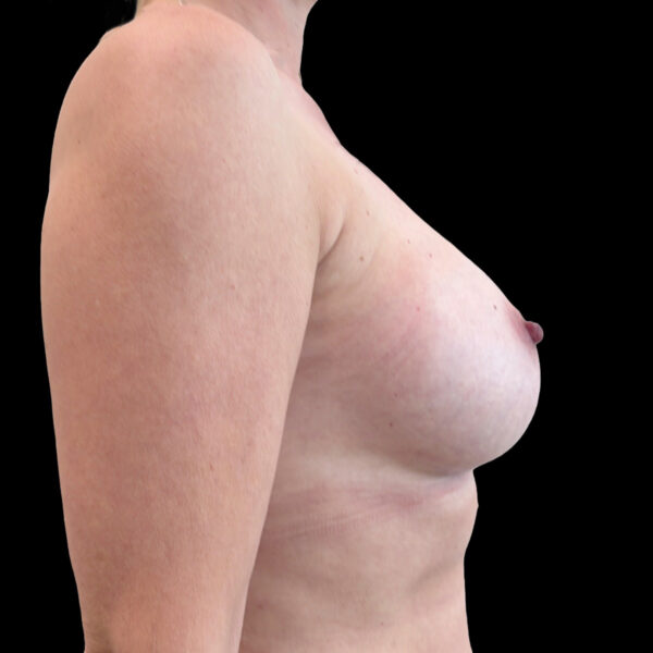 BFO. Mentor anatomisk M+ 420 ml.